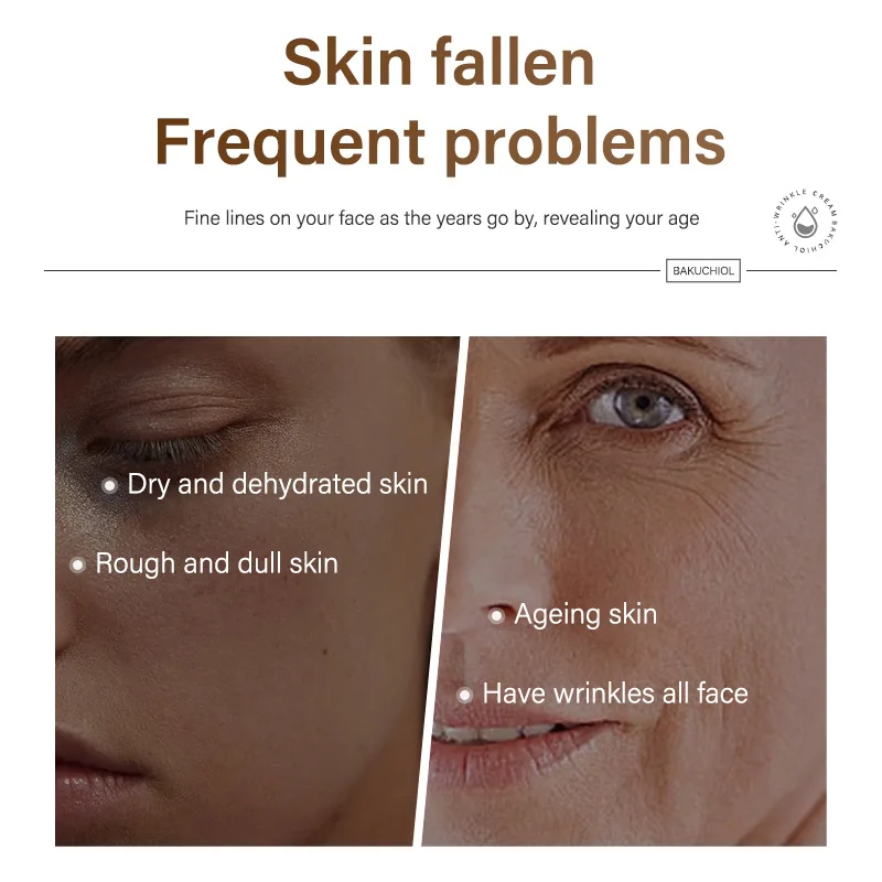 Anti Wrinkle Cream MOIKA Bakuchiol Anti-wrinkle Cream Psoralen Lighten Fine Line Acne Print Control Acne Firming 50ml