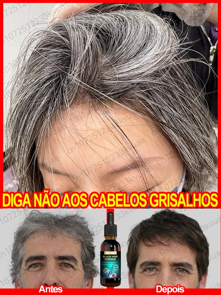 White hair treatment essence quickly turns white hair into black hair, repairs natural color, and prevents gray hair