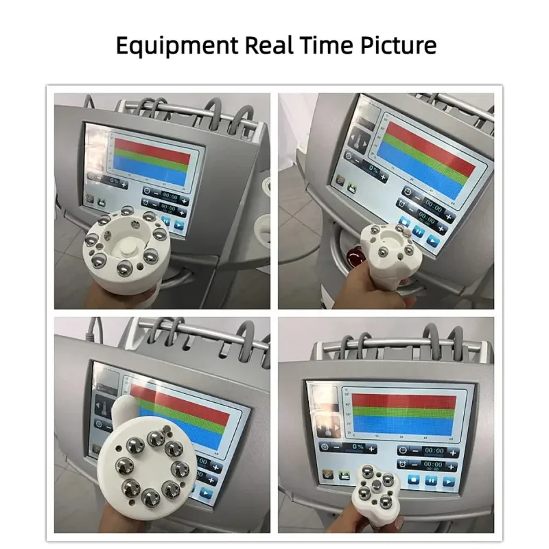 Рисунок 4 - Радиочастотный аппарат для контуринга