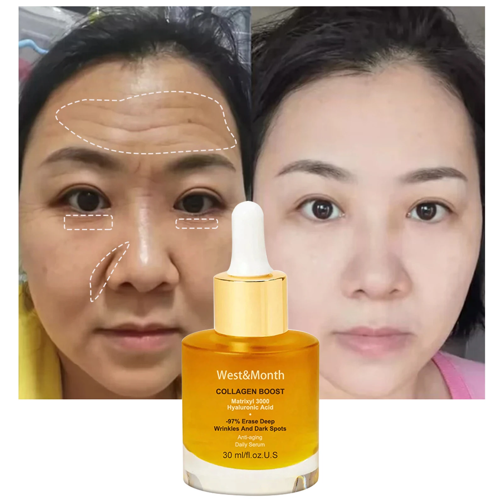 Collagen Anti Wrinkle Serum Boost Matrixyl 3000 -97% Erase Deep Wrinkles And Dark Spots Whitening Advanced Anti Aging Skin Care