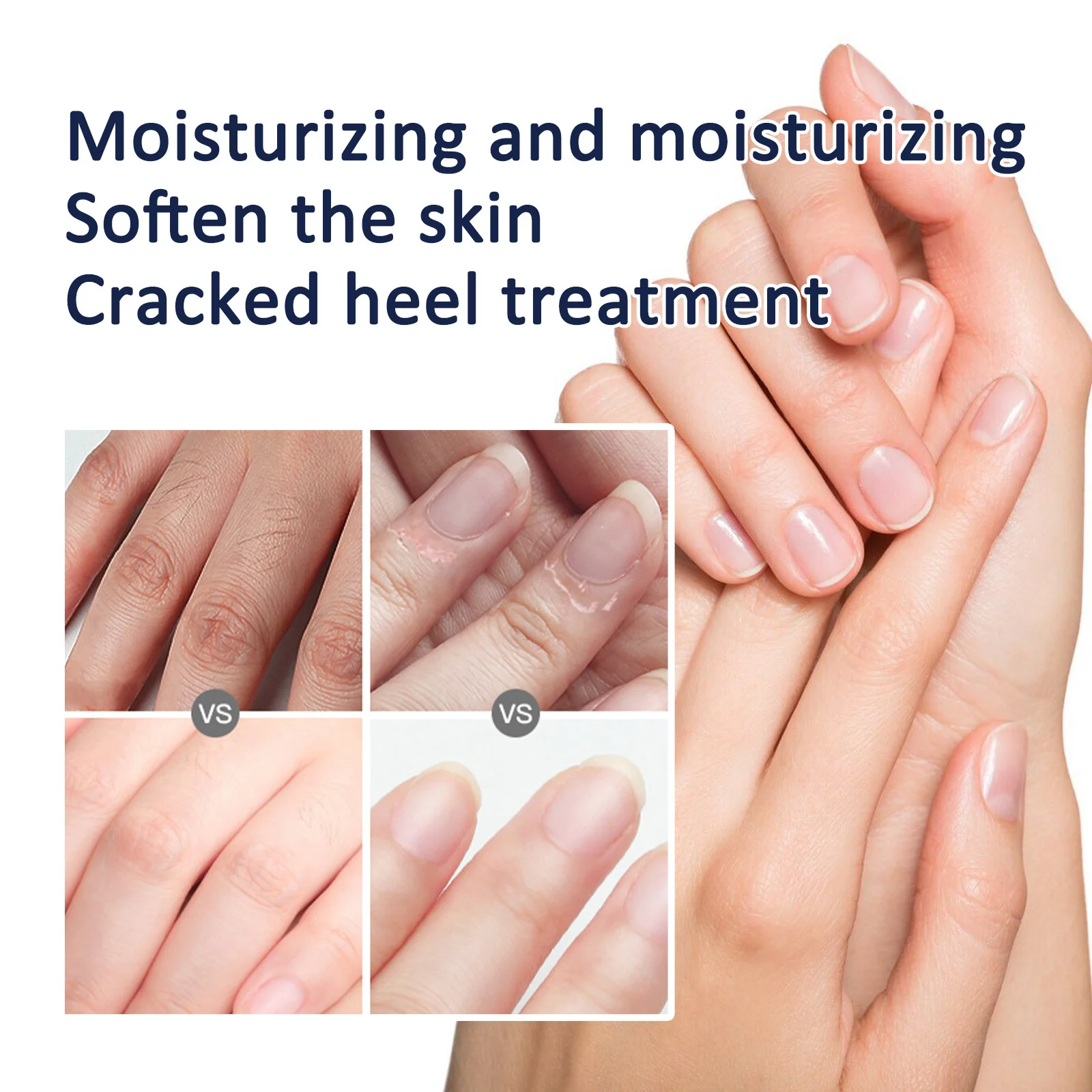 75G Anti-Drying Crack Foot Cream Stick Feet Callus Remover Skin Care Cream  Repair Foot Mask Dead Skin Remover Organic Spa Oil - AliExpress