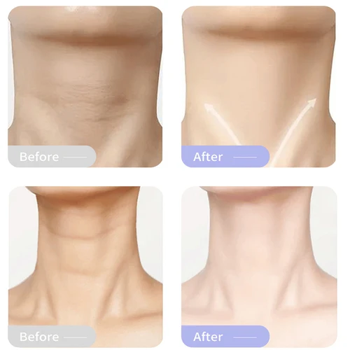 콜라겐 넥 크림 넥 퍼밍 링클 리무버 크림 리주버네이션 퍼밍 스킨 모양 뷰티 넥 스킨 케어 제품 4