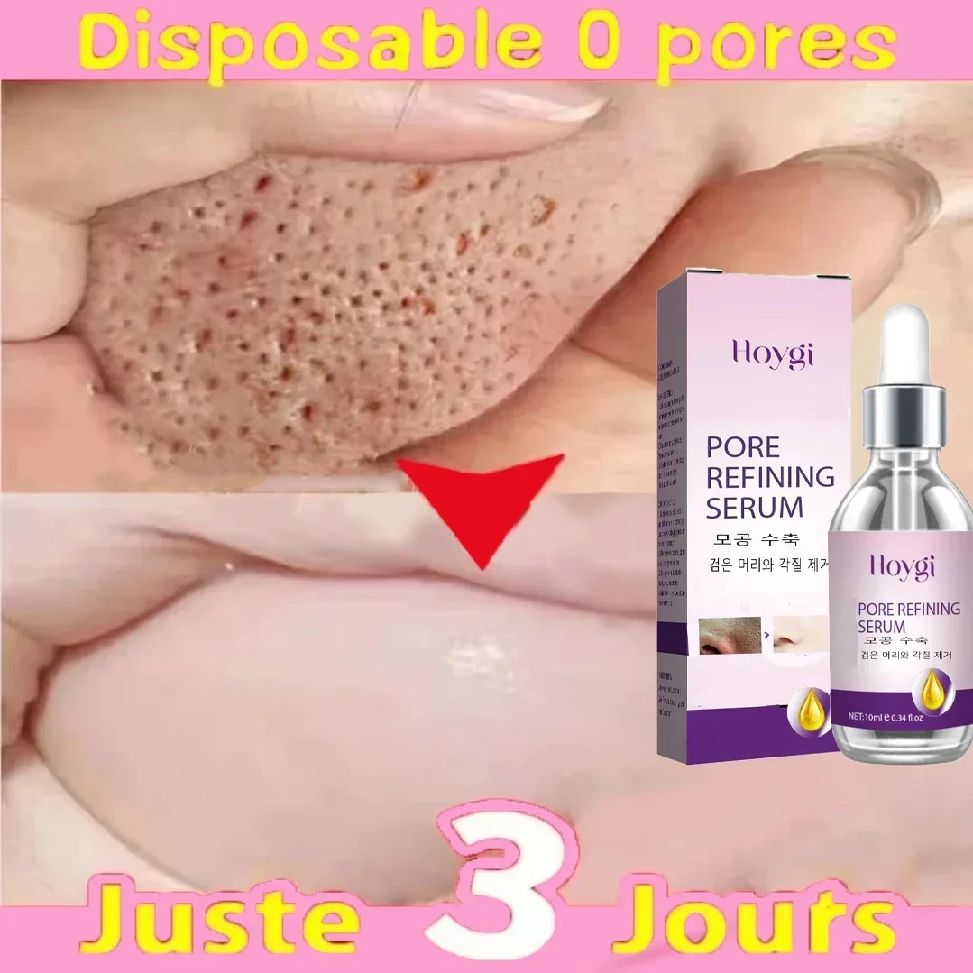 Textura de la piel refinamiento de los poros y regeneraci&oacute;n esencia facial sin acn&eacute;