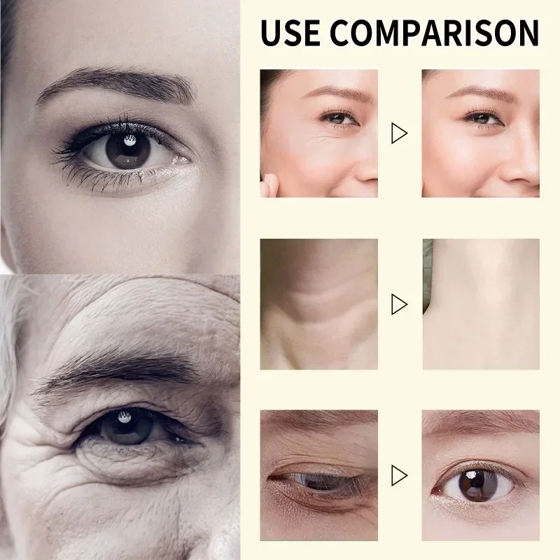 

Sdottor New Anti Wrinkle Essence Repair fine lines nasolabial folds neck lines facial Eyes firming skin anti-aging Moisturizing