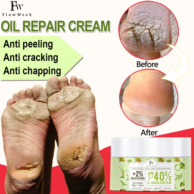 Flow Week Urea Cream Hand Foot Cream Callus Remover Salicylic Acid Moisturizing Anti-dry Heel Cracked Repair Cream Feet Care: An Effective Solution for Dry and Cracked Skin