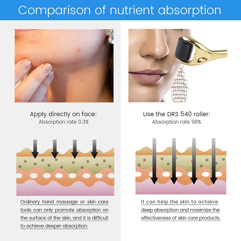 Facial Microneedle Roller Massage DRS 540 Derma Roller Needle Instrument Face Roller Massager Needles Skin Care Tool for Face - Image 3