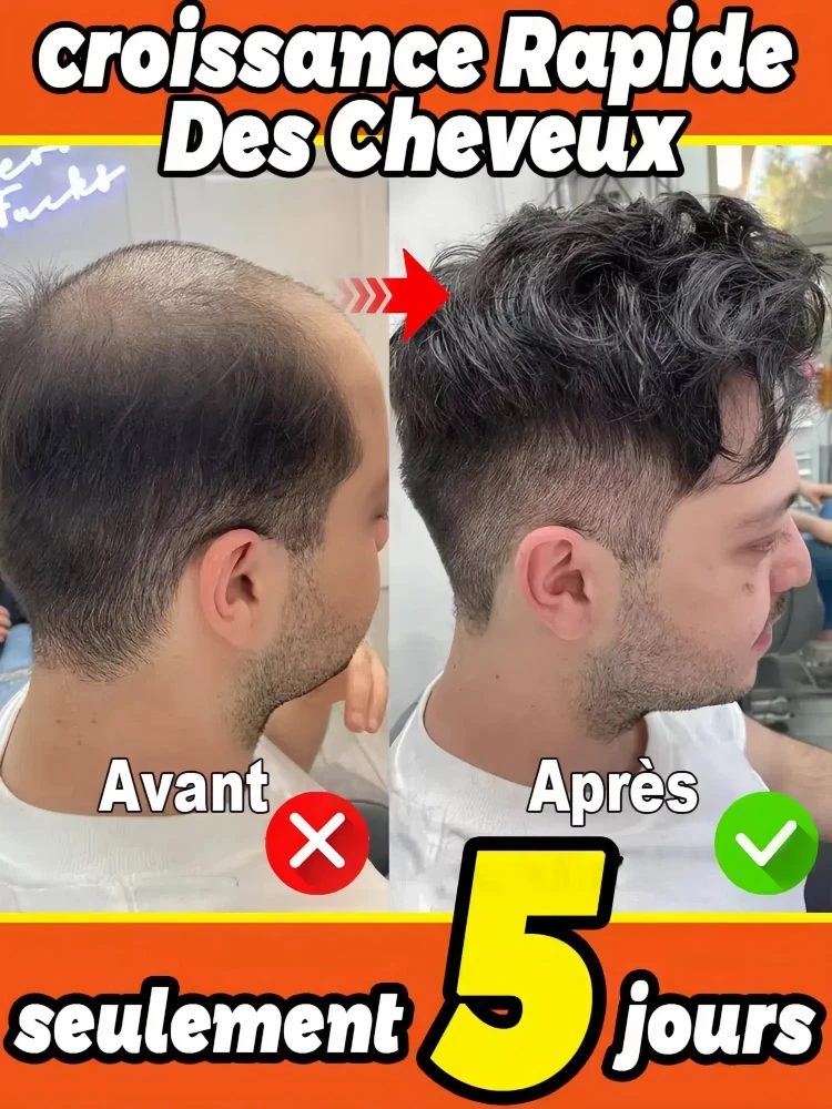 Revive Hair Strong Penetration Activate Hair Roots More Hair Say Goodbye to Baldness Thick Hair hair growth serum hair building powder hair building fibers hair growth spray hair growth cream hair growth shampoo set