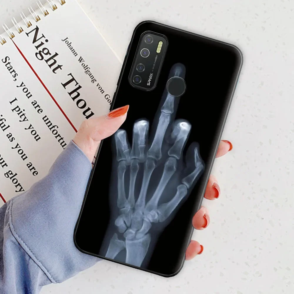 Elegant TPU Silicone Phone Case with Stylish Bumper Shell Design
