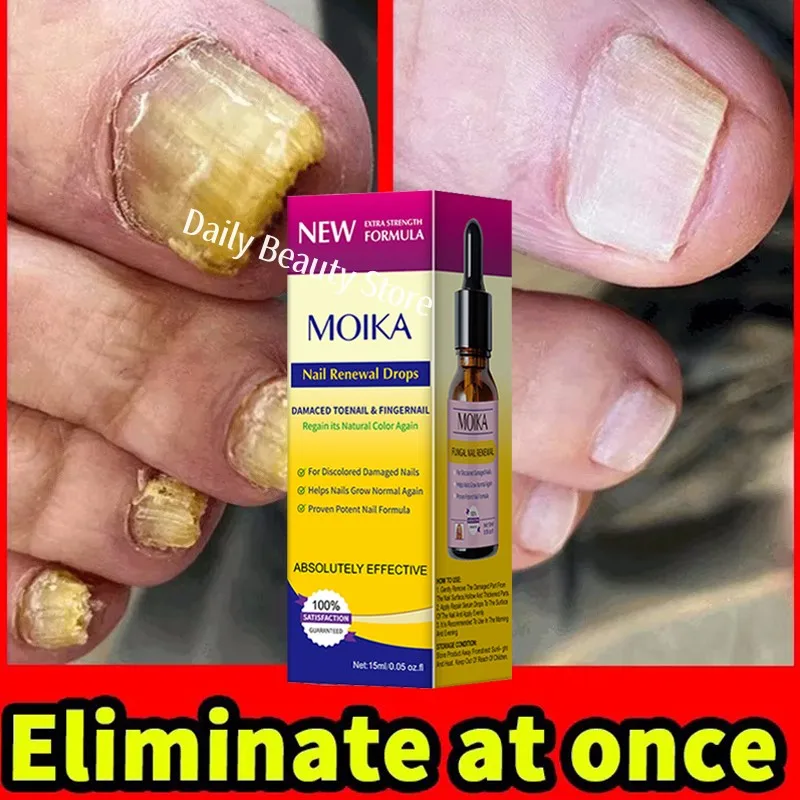Fungal nail treatment serum foot nail fungus removal repair gel anti infection paronychia onychomycosis foot nails care essence