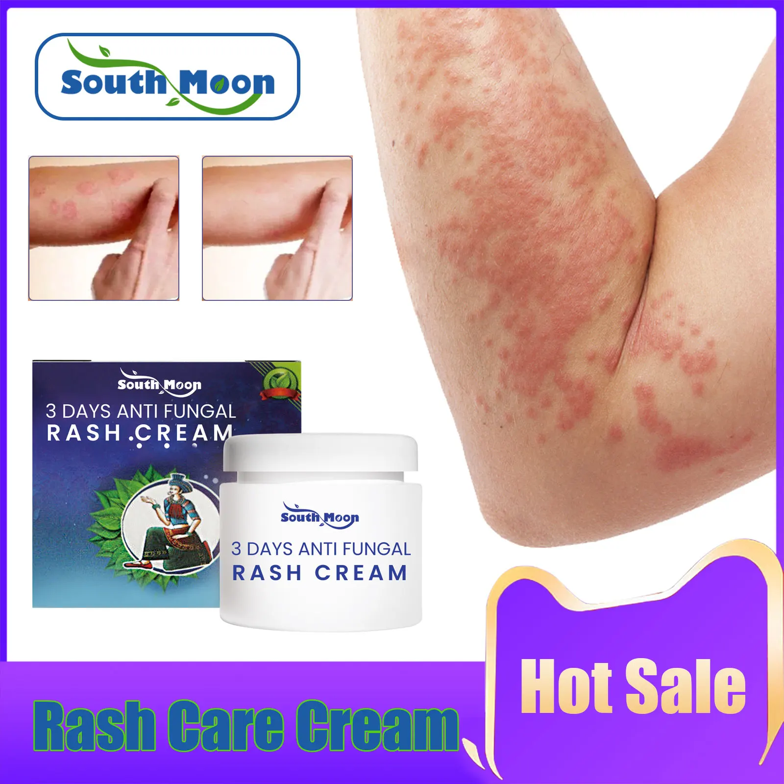 

Rash Psoriasis Treatment Cream Relieve Eczema Desquamation Anti Moss Ointment Skin Itching Relief Care Dermatitis Repair Cream