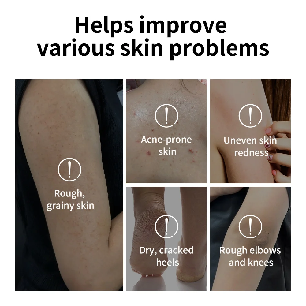 Glycolic Acid Exfoliating Body Stick for Smooth, Soft Skin with Deep Hydration