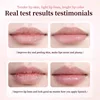 Remove Dark Lip Balm Lighten Melanin Gloss Oil Exfoliating Clean Pigment Dead Skin Moisturizer Fade Lip Lines Beauty Health Care 3