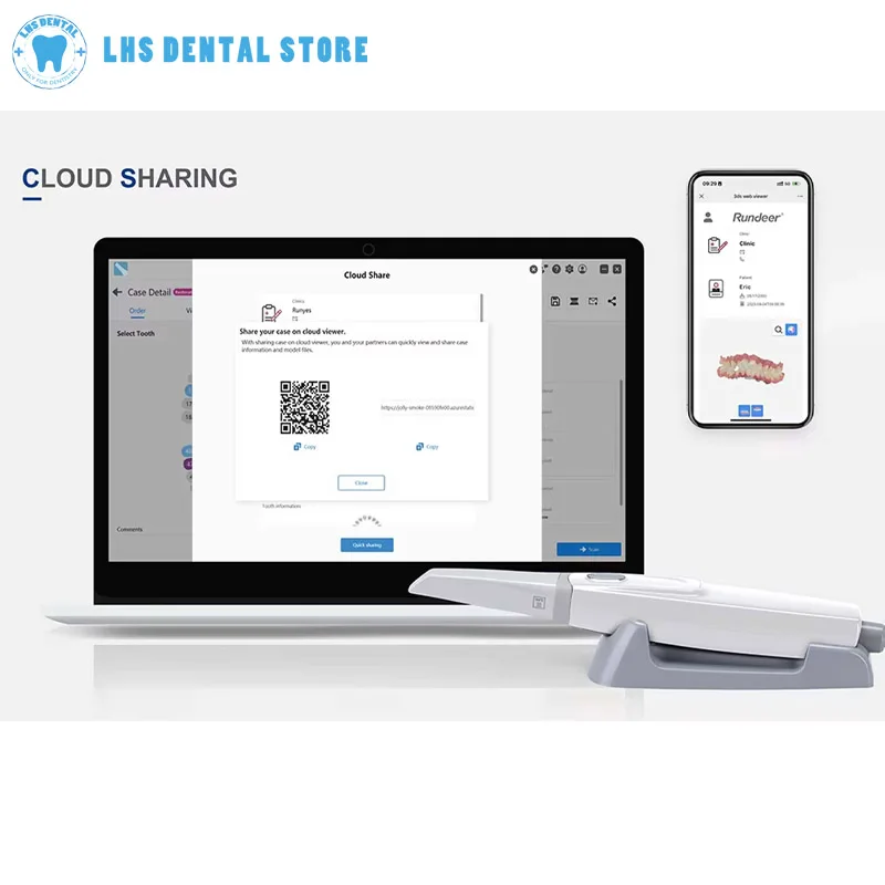 Scanner Dentale 3D con Scansione AI e Scansione a Colori 3D, Acquisizione Rapida di Impronte in 90 Secondi, Scanner Intraorale Dentale - immagine 3