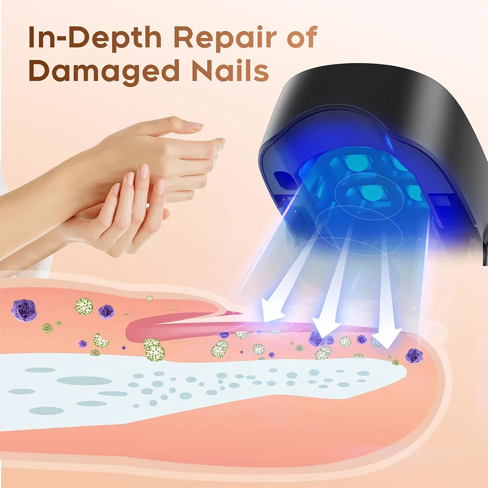 Nail Fungus Remover Manicure Pedicure Tools Personal Health Care Nail Care Device Fungal Treatment Repairing Thickened Gray Nails Relieve Ingrown Nail Cleaning