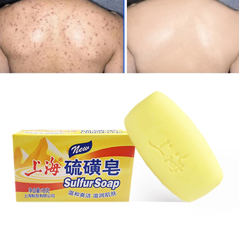 5PCS Shanghai Sulfur soap Bath soap Clean wash hands and face clean unisex behind the skin face deep clean