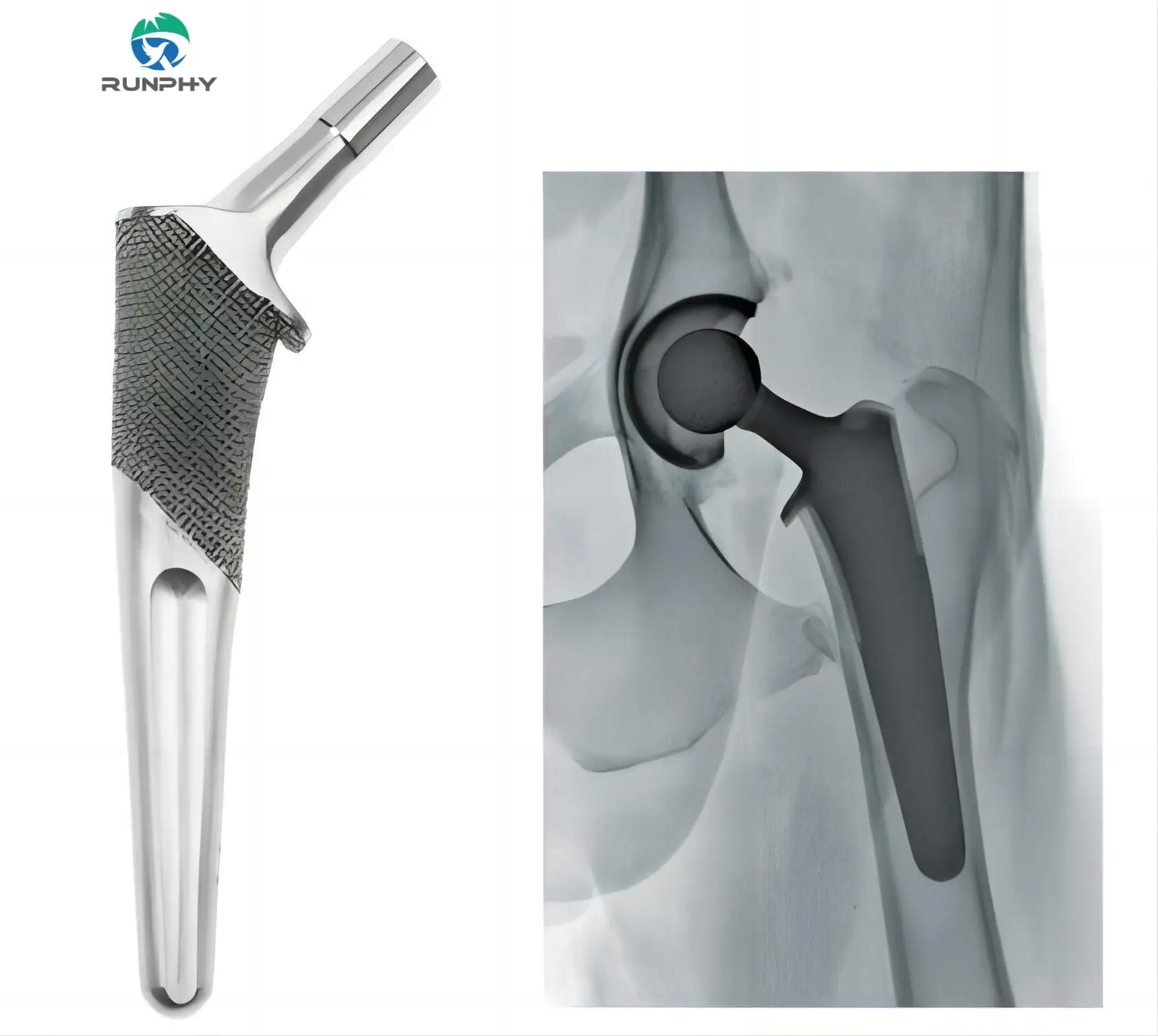 

Vetenairy Orthopedic Implant Cementless THR Canine Coxofermoral Osteoarthritis Canine Total Hip Replacement