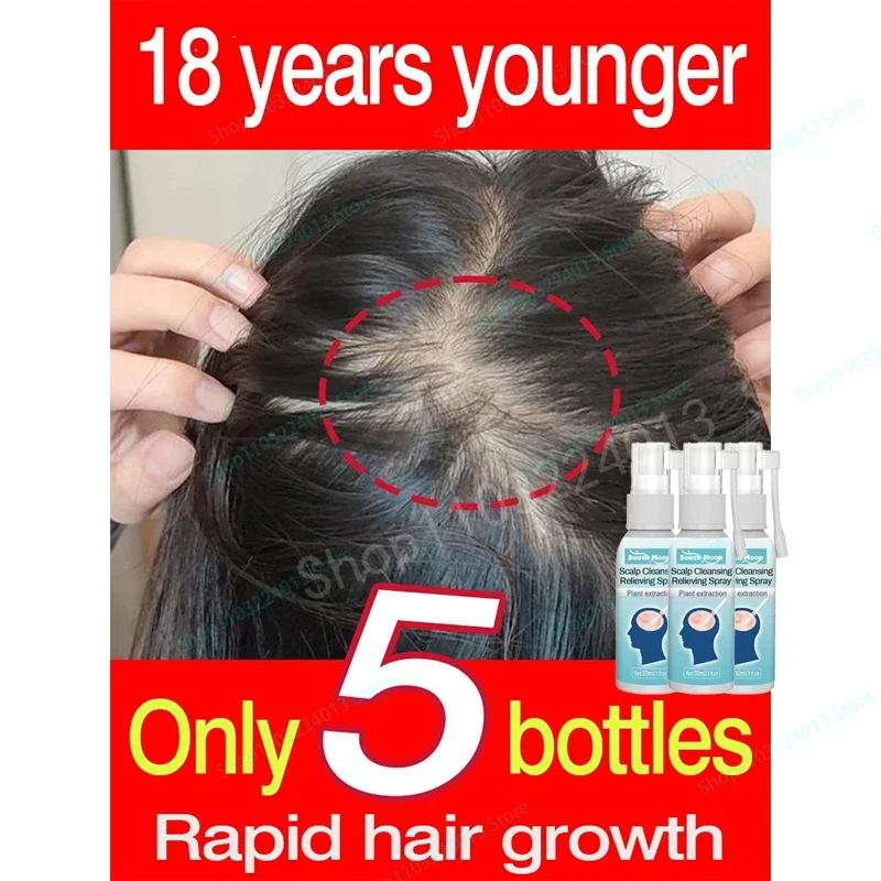 

Hair Growth Oil Fast Hair Growth Effective Baldness Repair Hereditary Hair Loss Postpartum Hair Loss Seborrheic Hair Loss