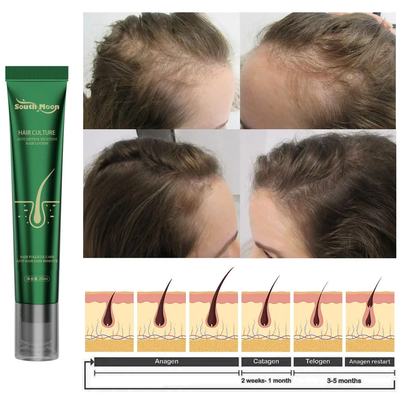 10PCS Biotin Schnelles Öl Haarwachstumsserum Haarverdünnungsbehandlung Flüssigkeit Anti-Haarausfall für Frauen und Männer_voghion.com