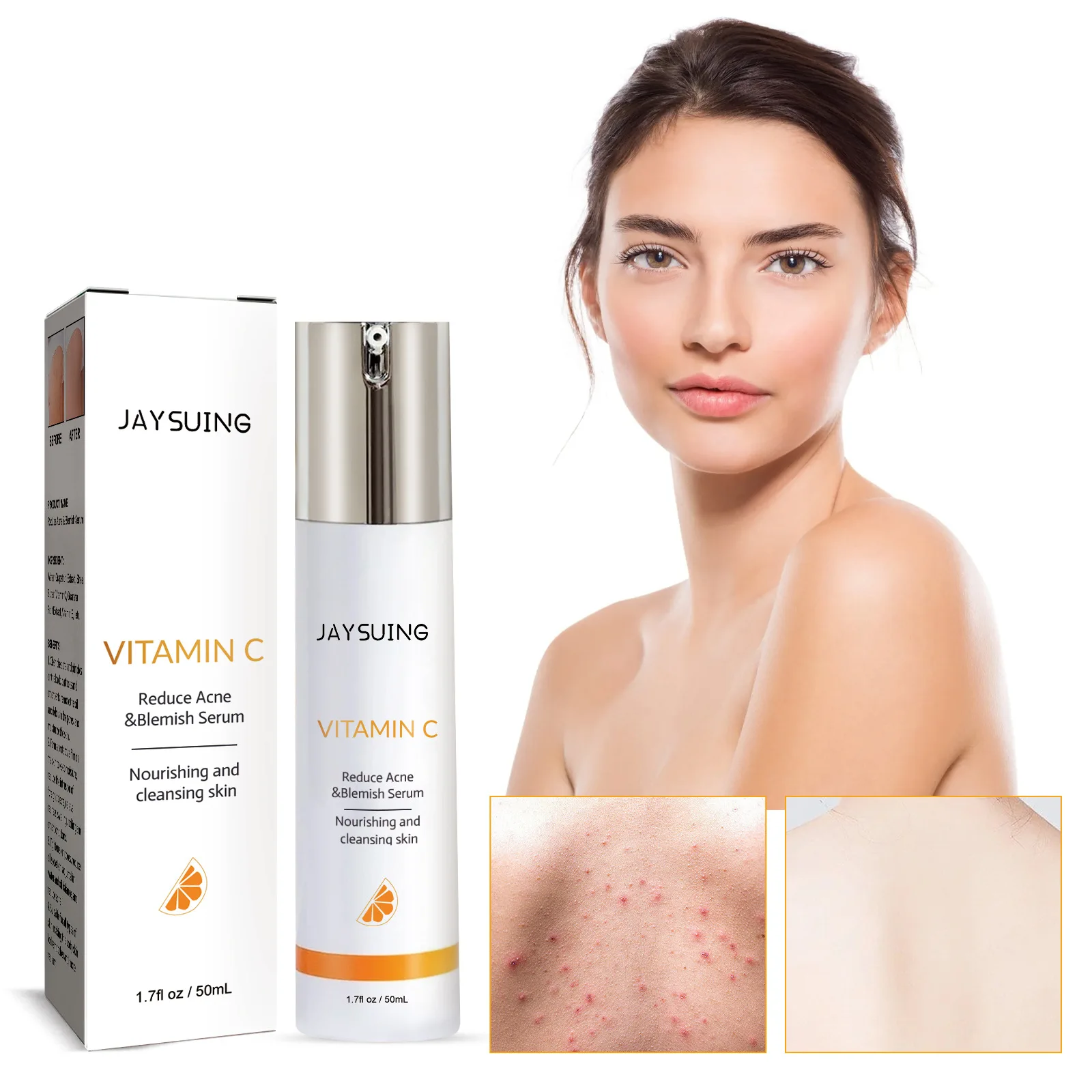

Reduce Acne & Blemish Serum Relieve Redness Swelling Itching Tighten Pores Balance Water Oil Remove Black Spots Brighten Skin