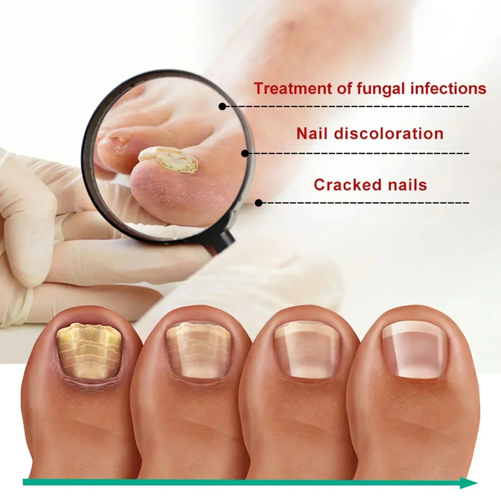 Stay away from bad nails Get beautiful nails nail problem solving nail repair