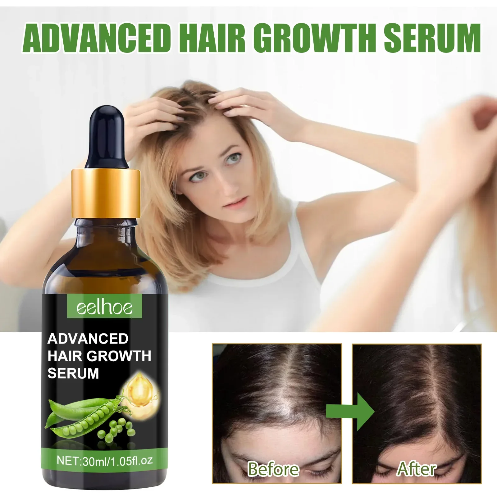 30ml Eelhoe Castor Oil Hair Essence Moisturizing Hair Root Nutrition Scalp Care Strong and Tough Anti-Fall Hair-Fixing Deny