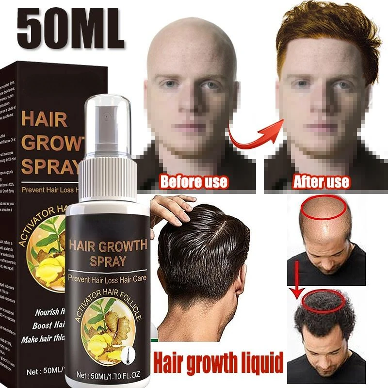 

Hair Growth Essence Natural Beauty Hair Spray Hair Growth Professional Brazilian Keratin Hair Growth Oil for Black Women