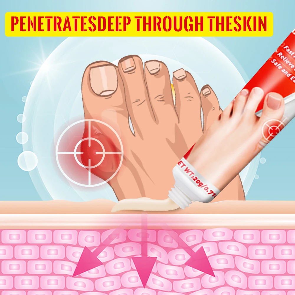 Pain Relief Cream Bunion Balm Gout Treatment 20g/pc