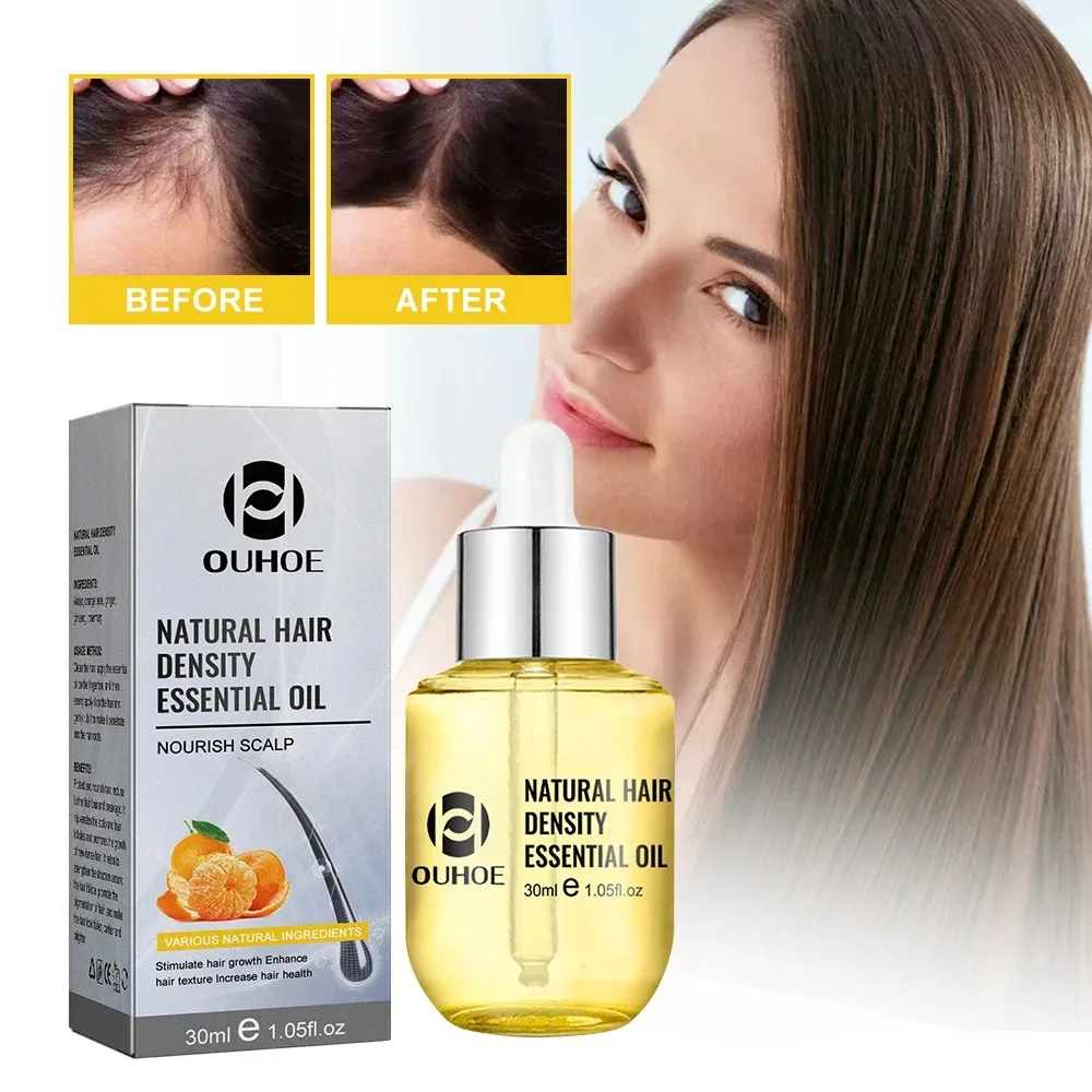Natural Hair Growth Essential Oil Ginger Essence Hair Regrowth Thicken Treatment Anti Loss Gift Set For Men Women