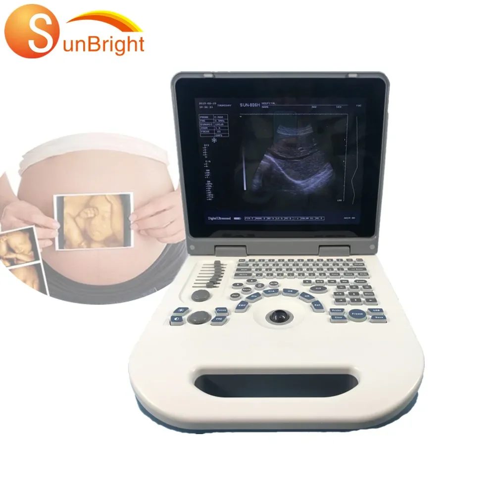 CheapestpriceSunbrightportableultrasound2Dmedicaldiagnostic
