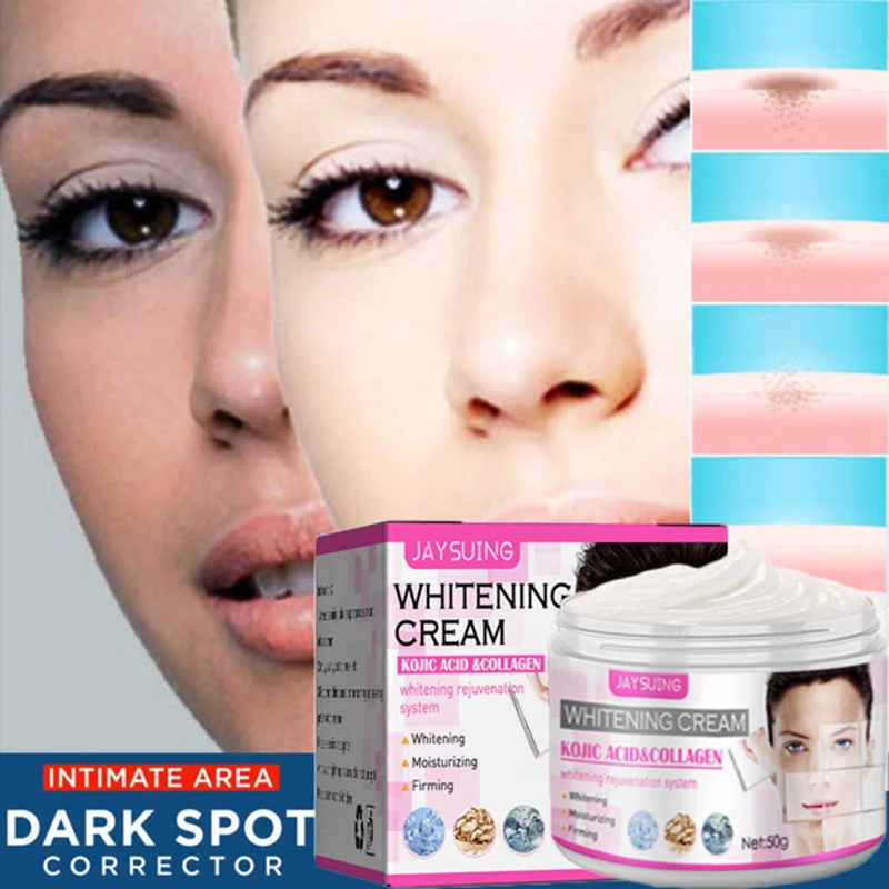 Strong Whitening Cream Freckle Remove Melasma Acne Armpit Knee Dark