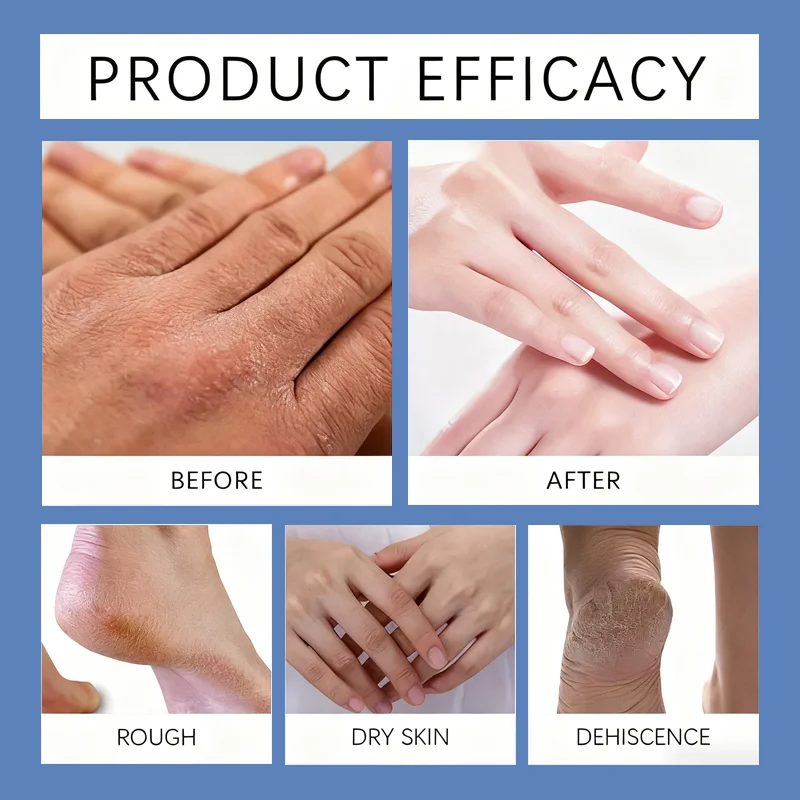 High-quality magnesium cream cares for the skin, absorbs easily, provides deep hydration, and is suitable for all skin types.