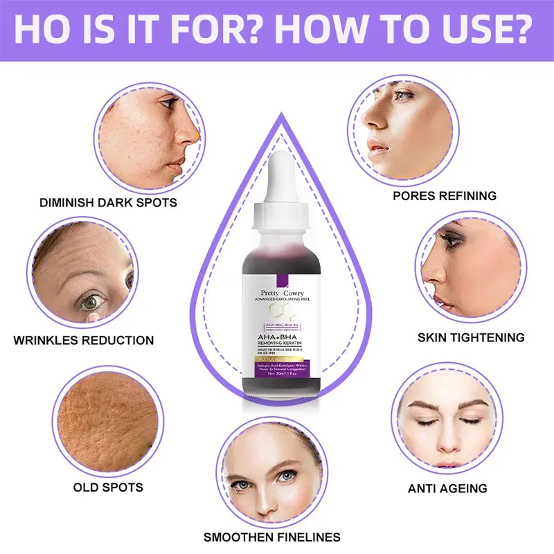 AHA 30% + BHA 2% Exfoliating Face Peel Serum – Gentle Chemical Exfoliator for Dark Spots, Pore Minimizing & Skin Renewal 4
