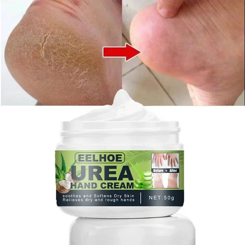 

50g Urea 42% Foot Cream Hand Anti Cracking Moisturizing Calluses Dead Skin Repair Rehydration Soften Cuticle Smooth Restore
