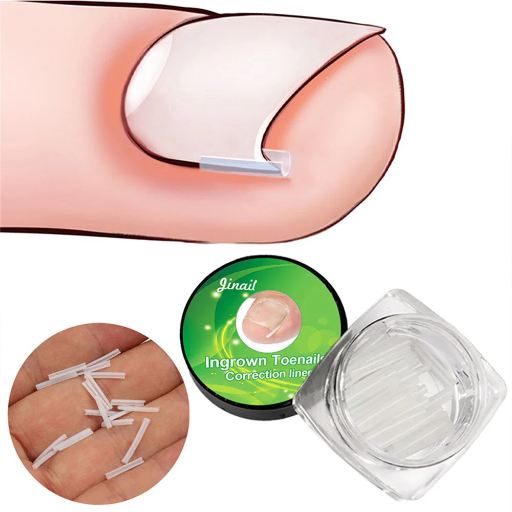 

10PCS Ingrown Nail Pad Toenail Correction Tools Treatment Patch Stickers Straightening Clip Brace Orthopedic Pedicure Foot Care