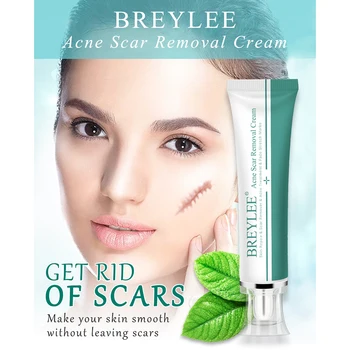 

BREYLEE Acne Scar Removal Cream 30g Face Cream Skin Repair Skin Care Scar Acne Treatment Remove Stretch Marks Whitening Cream