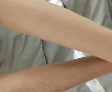 Máquina portátil de depilación, diodo láser de 808nm, Para rejuvenecimiento de la piel, máquina de depilación de 808nm, Envío Gratis