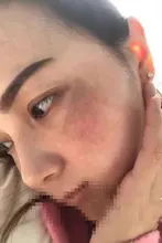 Crema blanqueadora para pecas, crema facial de hierbas chinas, elimina pecas y manchas oscuras, 30g