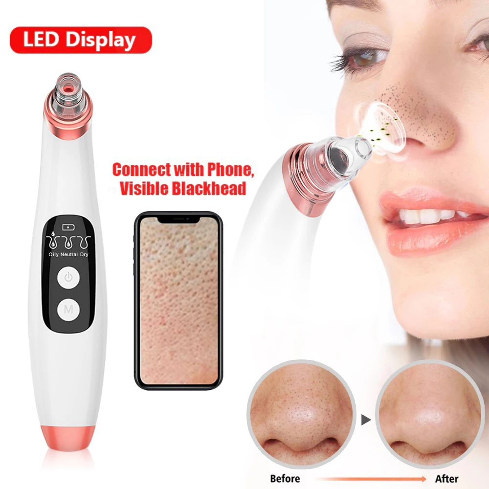 Pore-Cleaner-Spot Pimple-Removal Acne Black-Head Face-Skin-Care-Tools Vacuum-Suction
