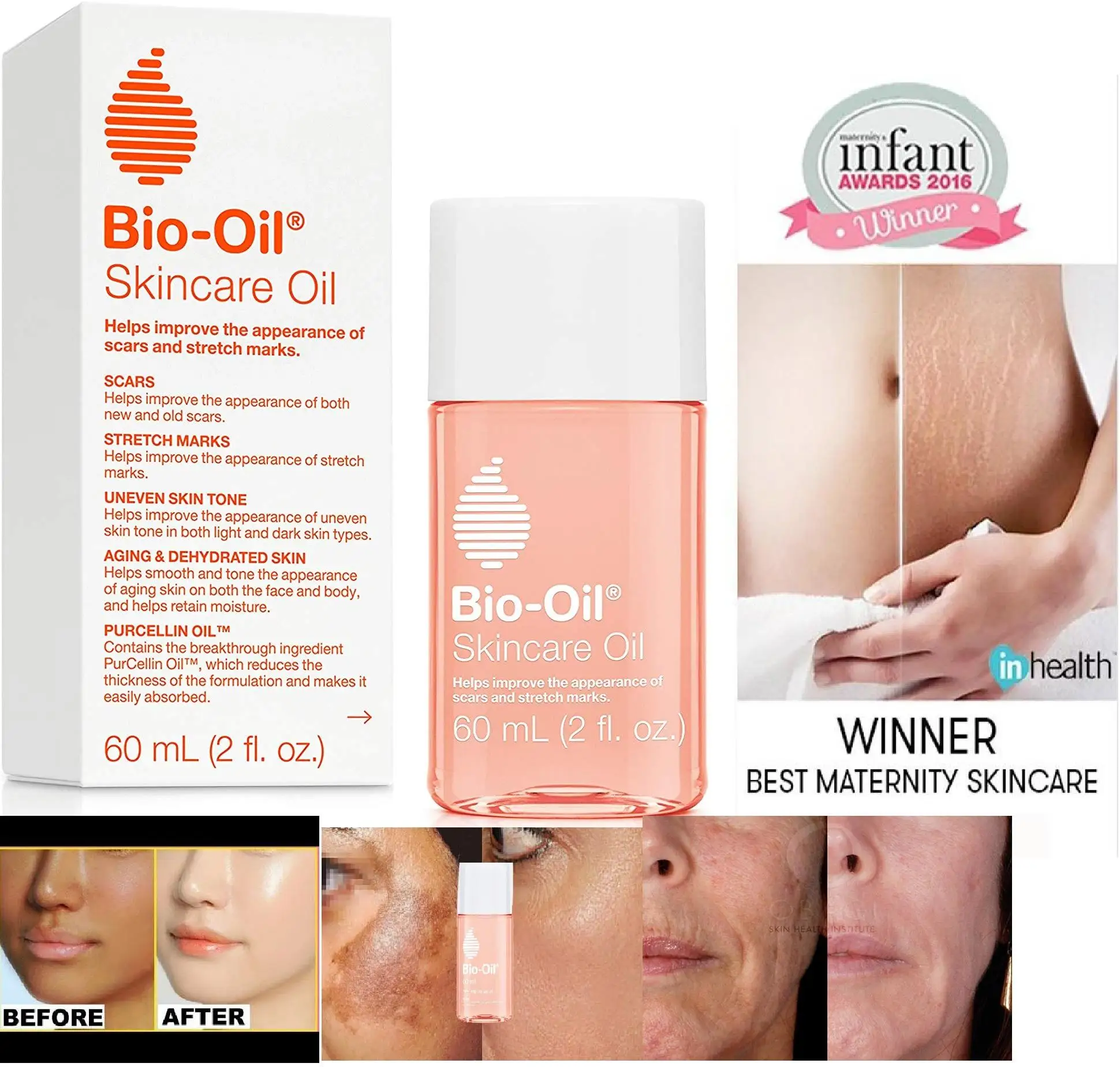 Bio-Oil Anti-Stretch Mark & Moisturizing Skin Care Oil 200 ml