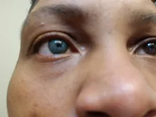 2 unids/par EE. UU. Venta caliente 5 tonos de lentes de contacto de Color 100% cubierta profunda cosméticos para ojos de lente de contacto para Eeys envío rápido lente póngase en contacto con