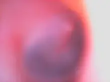 HD 1080P 3,9mm Digital de oído otoscopio 2.0MP WiFi oído Cámara endoscopio cera herramientas de eliminación de boroscopio de herramienta de limpieza del oído