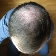 Sevich-Polvo de línea de pelo 4g Unisex, sombra de pelo, corrector de pelo, cobertura Natural, producto para la pérdida de cabello