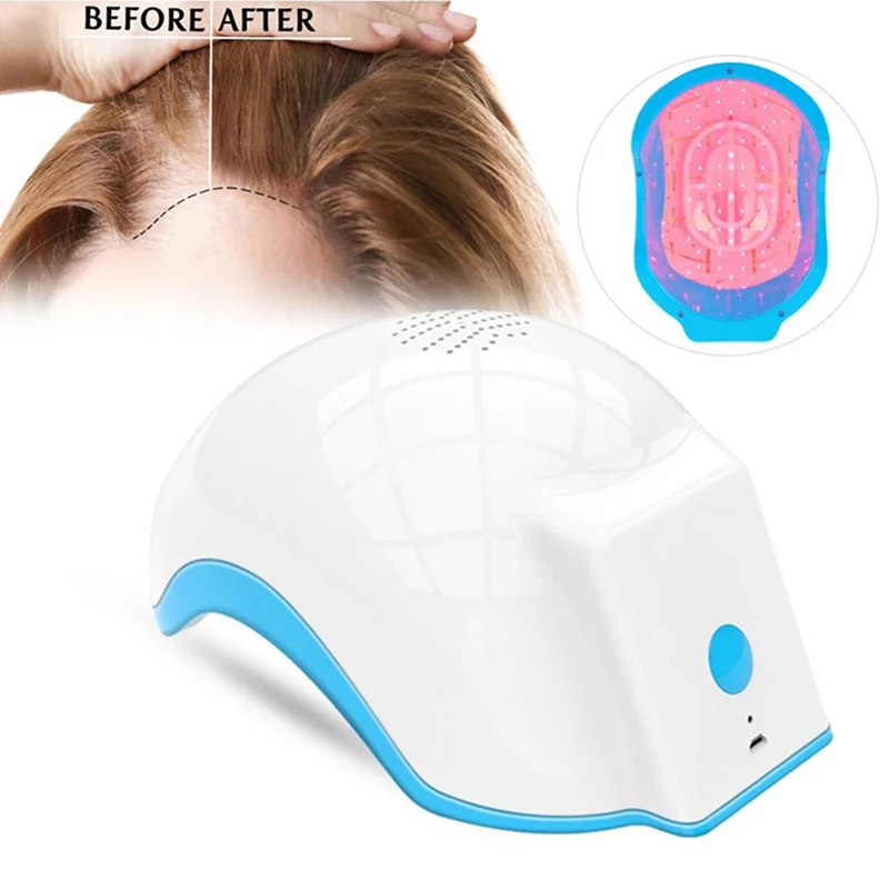 Recharge Hair Regrowth Helmet 80Pcs 272PCS Beads Light LED Hair Fast Growth Treatment Cap Anti-Hair Loss Product for Women Men