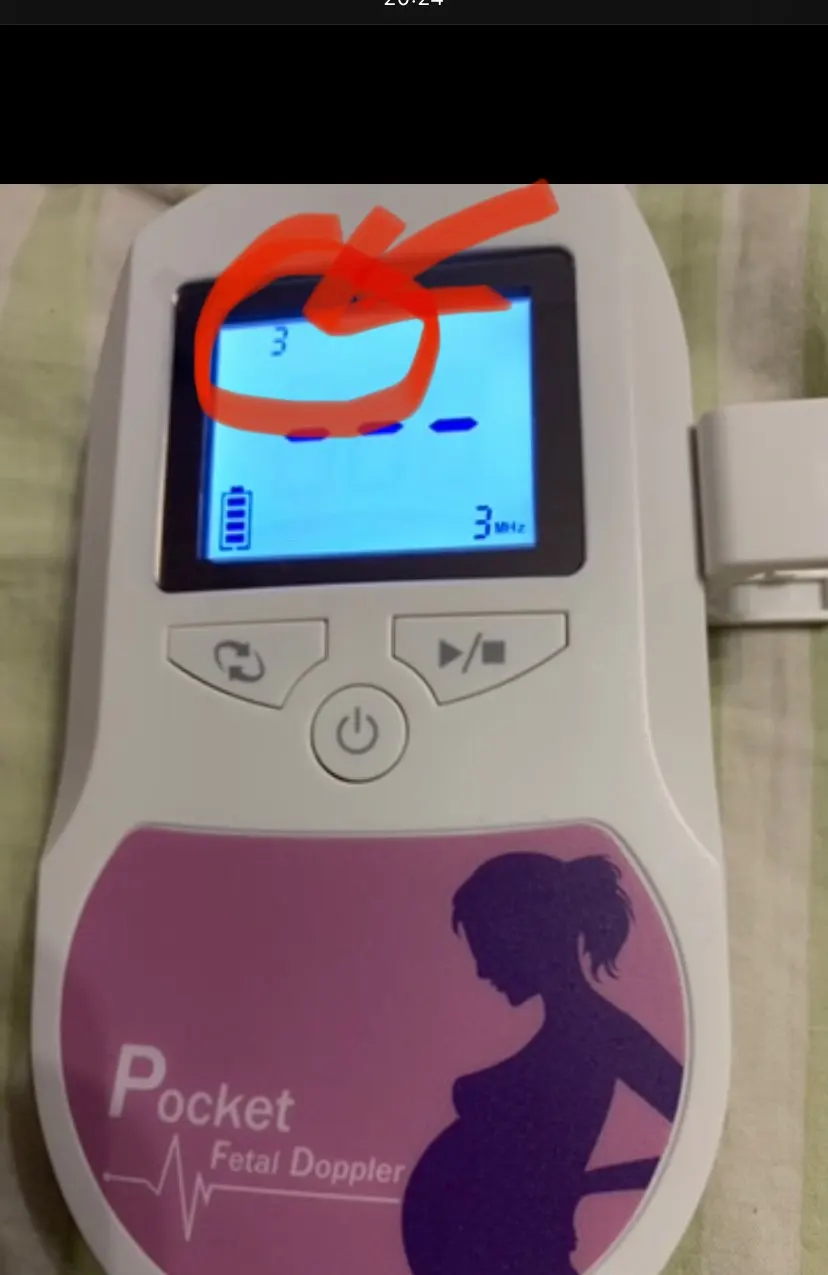 Ручной доплеровский прибор. Доплее. Фетальный допплер sonoline c. Эффект доплера в узи сосудов. Фетальный допплер contec pocket fetal doppler.