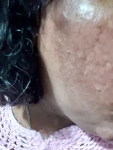 Crema facial antimanchas para hombres y mujeres, crema hidratante para la piel, reafirmante, elimina pecas y acné, pigmento, melanina