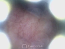 Endoscopio de limpieza de orejas, herramienta boroscopio para el cuidado de la salud, endoscopio, USB, Visual, 5,5mm, cámara de 0.3MP, Android, PC