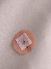 Removal-Machine Skin-Tag-Removal Wart Plasma-Pen Led-Lighting Laser-Tattoo Mole Dark-Spot-Remover