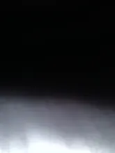 Removedor de espinillas y nariz con acné, utensilio para quitar espinillas y comedones, aguja para quitar acné, acero inoxidable