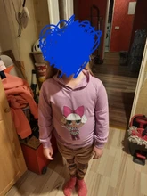 LOL Surprise-sudadera con capucha para niños y niñas, camisa con estampado de dibujos animados, Tops, sudadera, ropa informal