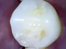 Cámara Dental inalámbrica con WiFi, endoscopio Intraoral ajustable, 1080p, HD, 8 luces LED, Cable USB, herramienta de inspección bucal para dentista